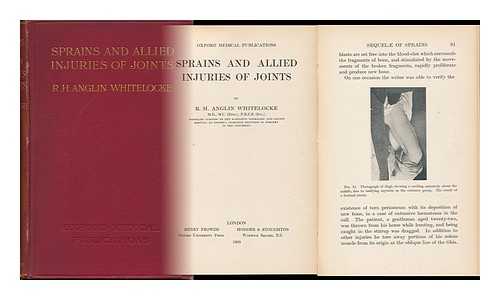 WHITELOCKE, RICHARD HENRY ANGLIN (1861-) - Sprains and Allied Injuries of Joints, by R. H. Anglin Whitelocke ...