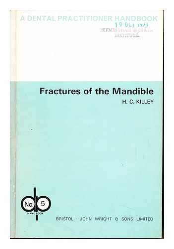 KILLEY, HOMER CHARLES - Fractures of the mandible