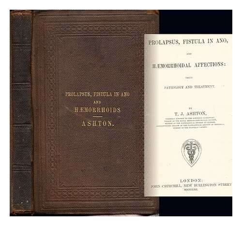 ASHTON, THOMAS JOHN. - Prolapsus, fistula in ano, and haemorrhoidal affections : their pathology and treatment