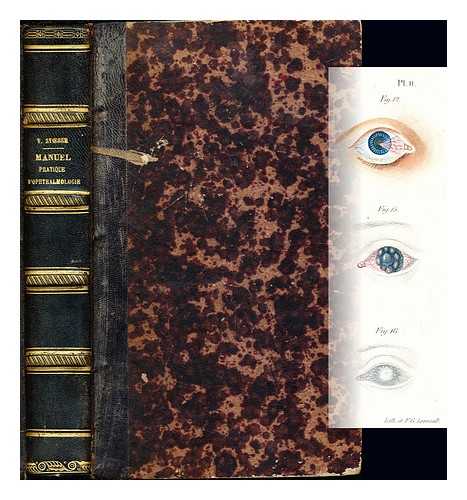 STOEBER, VICTOR (1803-1871) - Manuel pratique d'ophthalmologie : ou, Trait des maladies des yeux / par Victor Stoeber