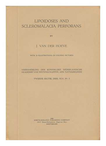 VAN DER HOEVE, J. - Lipoidoses and Scleromalacia Perforans